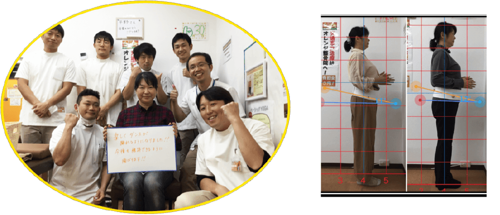 腰痛が改善した患者様の写真と姿勢ビフォーアフター