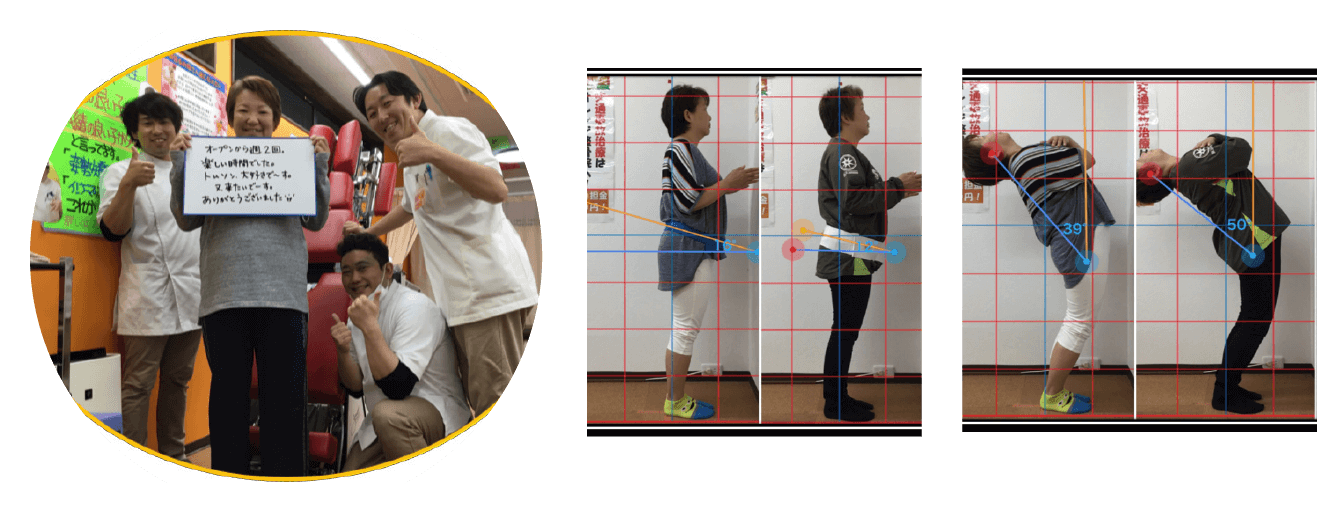 膝の痛みが改善した患者様の写真と姿勢ビフォーアフター