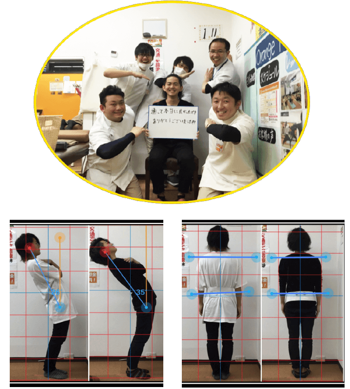 腰痛が改善した患者様の写真と姿勢ビフォーアフター