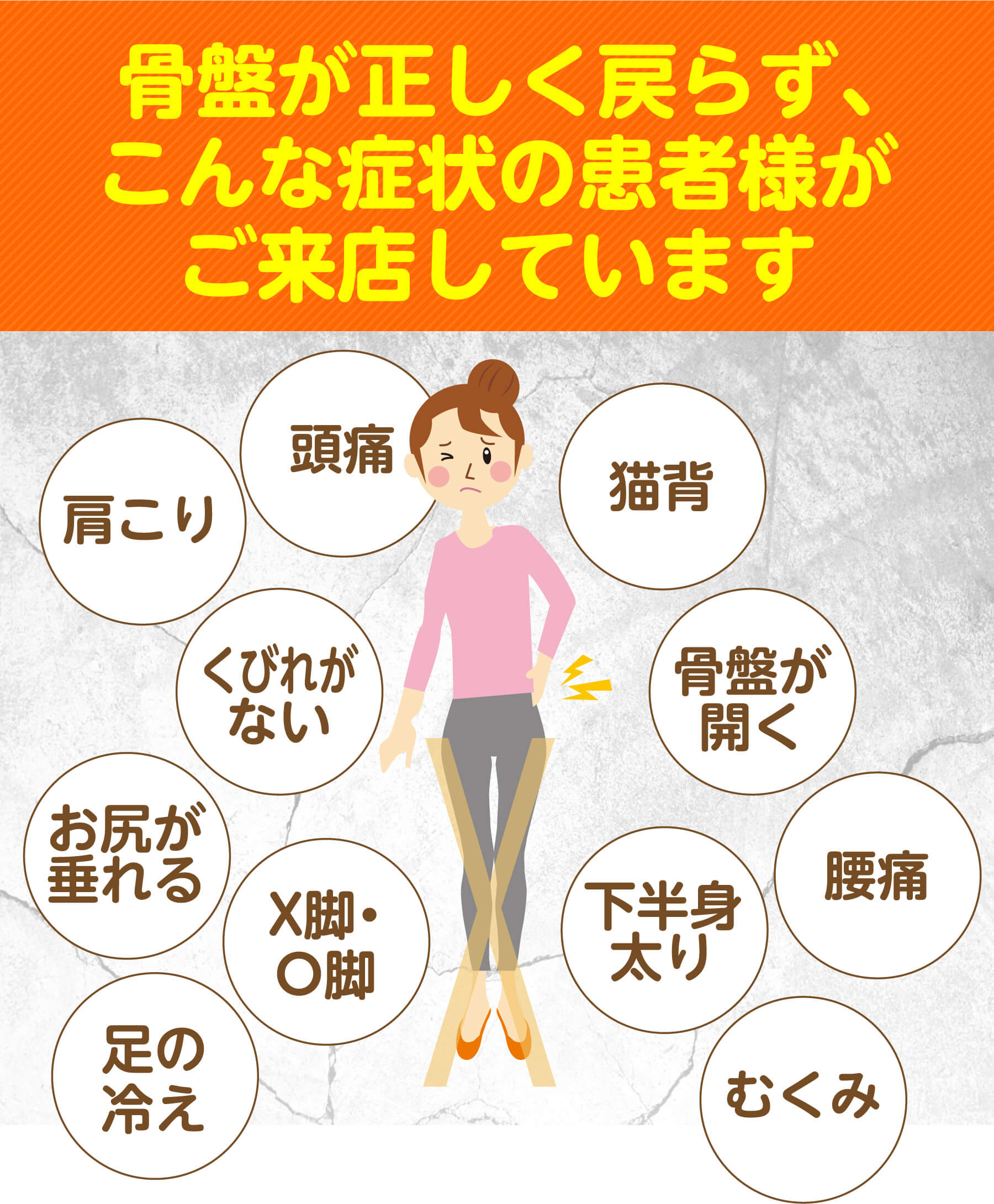 骨盤が戻らないまま、こんな症状で来られる方がいます（頭痛・肩こり・猫背・くびれがない・骨盤が開く・お尻が垂れる・X脚O脚・下半身太り・腰痛・足の冷え・むくみ）
